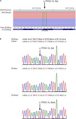 A Novel Whole Gene Deletion of BCKDHB by Alu-Mediated Non-allelic Recombination in a Chinese Patient With Maple Syrup Urine Disease